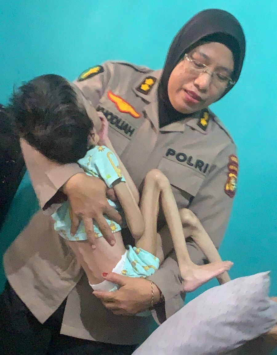 Kisah Pilu Siti Fadilla, Anak Penderita Hidrosefalus yang Dibuang Orang Tuanya Ini Tampak Ceria Digendong Polwan