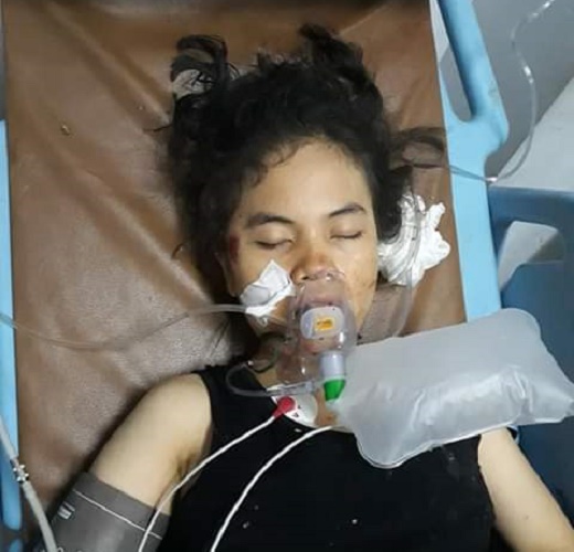 Jatuh Saat Dijambret, Seorang Wanita Terkapar Tak Sadarkan Diri