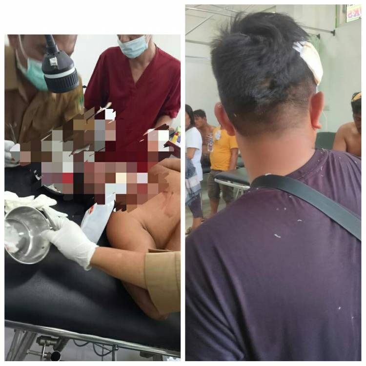 F-SPTI di Bagan Batu Bentrok, Puluhan Orang Luka-luka, Polres Rohil Panggil Dua Kubu