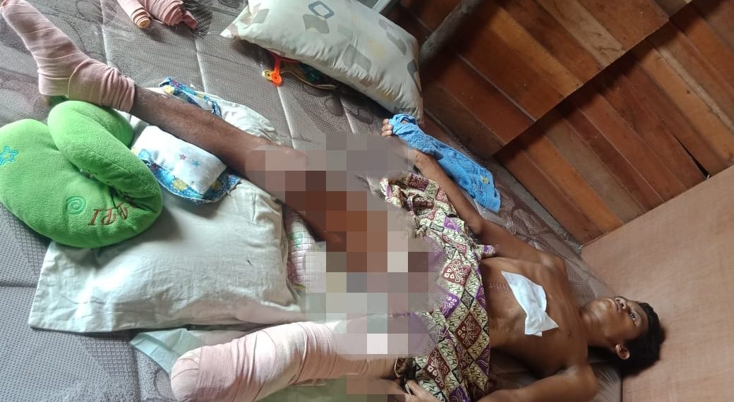 Kapolsek Tambang Bantu Warga Desa Kualu Korban Kecelakaan Dengan Kondisi Memprihatinkan