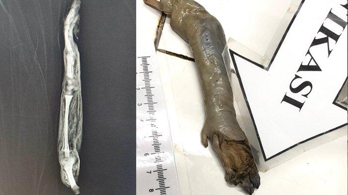 Ditemukan Potongan Tubuh Mirip Tangan Bayi di Kampar Kiri, Ternyata Ini Jawabannya